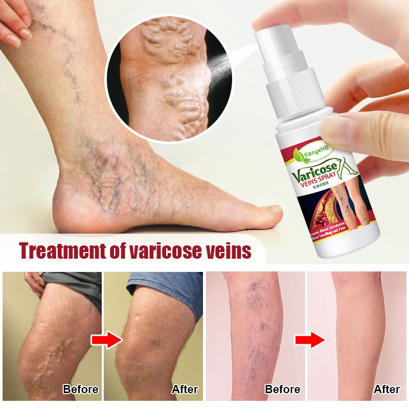 Líquido vascular para piernas